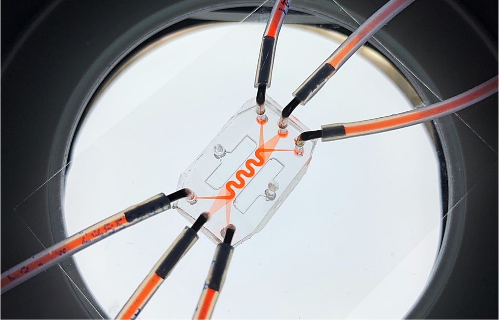 ‘GutonaChip’ Research Aims to Find Personalized Treatment for Crohn