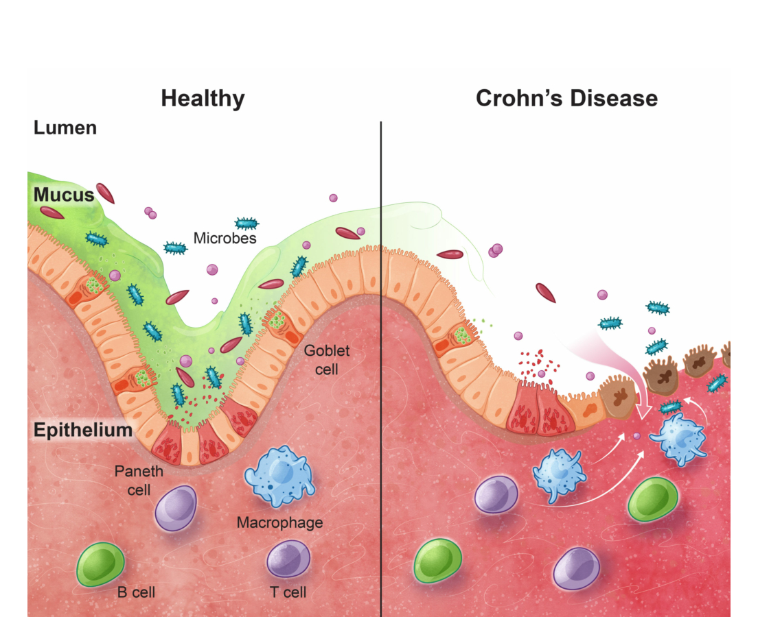 Disease Biology